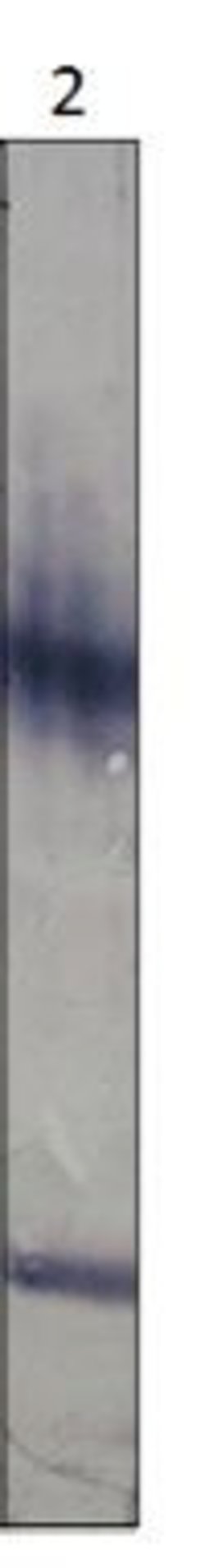 Invitrogen PDE11A Polyclonal Antibody 100 &mu;g | Buy Online | Invitrogen&trade; | Fisher Scientific