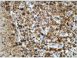 Invitrogen Calretinin Polyclonal Antibody 100 &mu;g | Buy Online | Invitrogen&trade; | Fisher Scientific