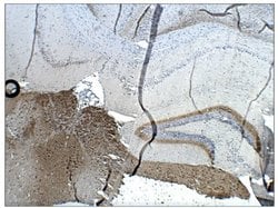 Invitrogen Calretinin Polyclonal Antibody 100 &mu;g | Buy Online | Invitrogen&trade; | Fisher Scientific