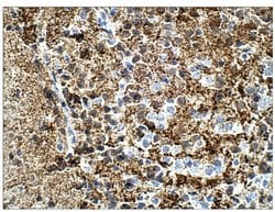 Invitrogen Calretinin Polyclonal Antibody 100 &mu;g | Buy Online | Invitrogen&trade; | Fisher Scientific