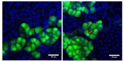Invitrogen NPR1 Polyclonal Antibody 100 &mu;g; Unconjugated:Antibodies,