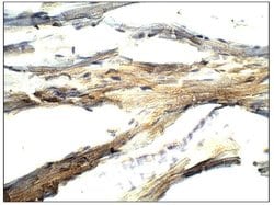 Invitrogen BMP-2 Polyclonal Antibody 100 &mu;g; Unconjugated:Antibodies,