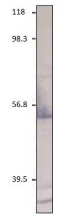 Invitrogen CXCR2 Polyclonal Antibody 100 &mu;g | Buy Online | Invitrogen&trade; | Fisher Scientific