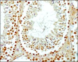 Invitrogen SCP3 Polyclonal Antibody 100 &mu;L; Unconjugated:Antibodies,