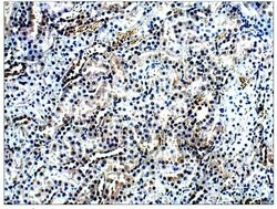 Invitrogen AMACR Polyclonal Antibody 100 &mu;g; Unconjugated:Antibodies,