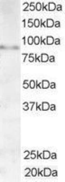 Invitrogen AKAP3 Polyclonal Antibody 100 &mu;g; Unconjugated:Antibodies,