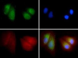 Invitrogen LIMP2 Polyclonal Antibody 100 &mu;L; Unconjugated:Antibodies,
