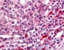 Invitrogen OGG1 Polyclonal Antibody 100 &mu;L | Buy Online | Invitrogen&trade; | Fisher Scientific