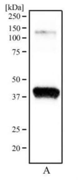 Invitrogen OGG1 Polyclonal Antibody 100 &mu;L | Buy Online | Invitrogen&trade; | Fisher Scientific