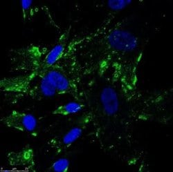 Invitrogen SR-BI Polyclonal Antibody 100 &mu;L; Unconjugated:Antibodies,