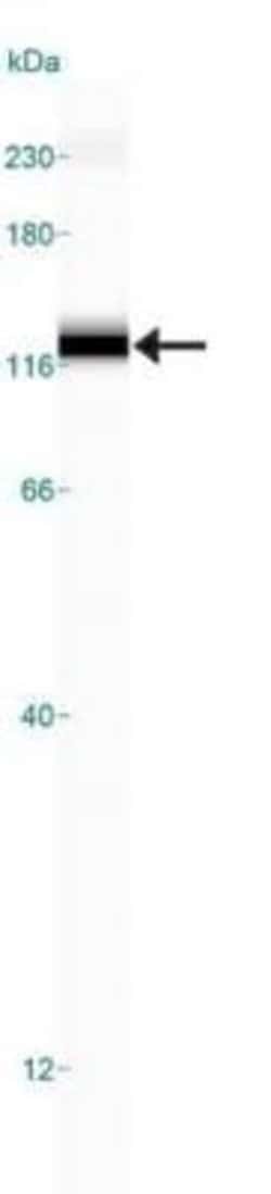 Invitrogen SR-BI Polyclonal Antibody 100 &mu;L; Unconjugated:Antibodies,
