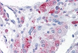 Invitrogen MTA1 Polyclonal Antibody 100 &mu;g; Unconjugated:Antibodies,