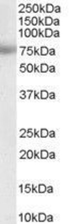 Invitrogen MTA1 Polyclonal Antibody 100 &mu;g; Unconjugated:Antibodies,