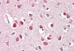 Invitrogen BAI1 Isoform 3 Polyclonal Antibody 50 &mu;g; Unconjugated:Antibodies,