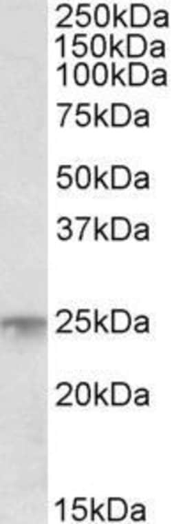 Invitrogen MSC Polyclonal Antibody 50 &mu;g; Unconjugated:Antibodies, Polyclonal