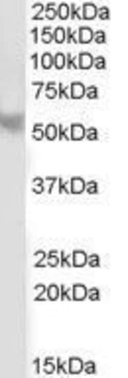 Invitrogen PPP2R5B Polyclonal Antibody 50 &mu;g; Unconjugated:Antibodies,