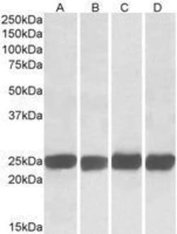 Invitrogen GRB2 Polyclonal Antibody 50 &mu;g | Buy Online | Invitrogen&trade; | Fisher Scientific