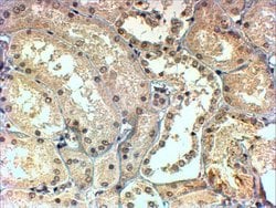 TBL1X/TBL1XR1 Polyclonal Antibody:Antibodies, Polyclonal