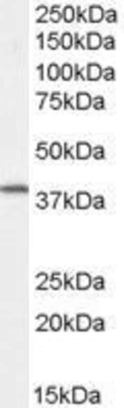 Invitrogen Dysadherin Polyclonal Antibody 50 &mu;g; Unconjugated:Antibodies,
