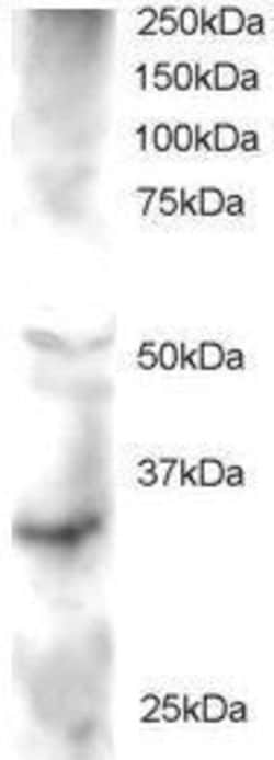 Invitrogen FRAT2 Polyclonal Antibody 50 &mu;g; Unconjugated:Antibodies,