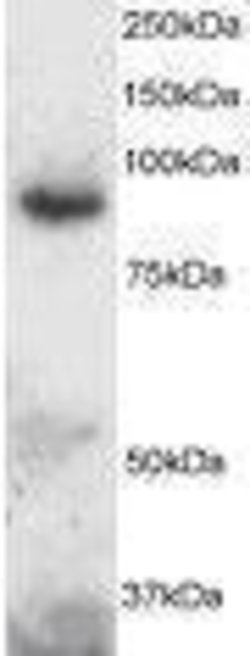 Invitrogen ADAM8 Polyclonal Antibody 50 &mu;g; Unconjugated:Antibodies,