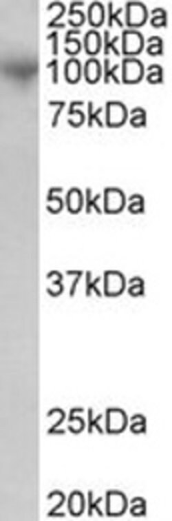 Invitrogen ADAM8 Polyclonal Antibody 50 &mu;g; Unconjugated:Antibodies,