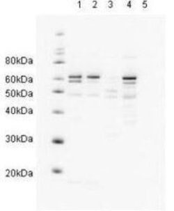 Invitrogen RAD23A Polyclonal Antibody 50 &mu;g; Unconjugated:Antibodies,