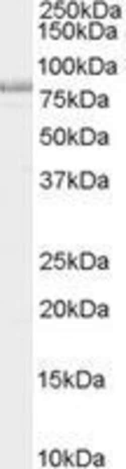 Invitrogen NUMB Polyclonal Antibody 50 &mu;g | Buy Online | Invitrogen&trade; | Fisher Scientific