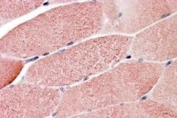 Invitrogen RNF90 Polyclonal Antibody 100 &mu;g; Unconjugated:Antibodies,
