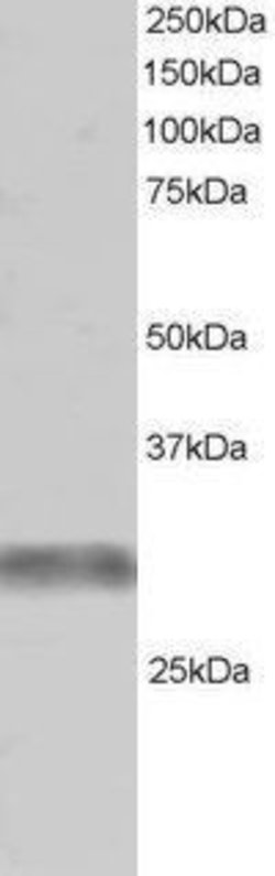 Invitrogen RNF90 Polyclonal Antibody 100 &mu;g; Unconjugated:Antibodies,