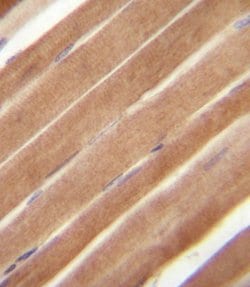 Invitrogen EphB2 Polyclonal Antibody 400 &mu;L; Unconjugated:Antibodies,