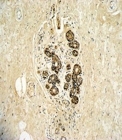 Invitrogen ErbB3 Polyclonal Antibody 400 &mu;L; Unconjugated:Antibodies,