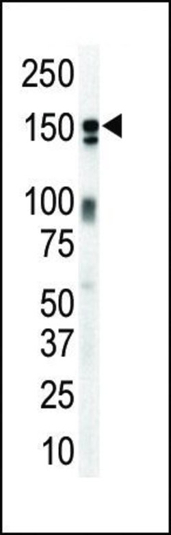 Invitrogen ErbB3 Polyclonal Antibody 400 &mu;L; Unconjugated:Antibodies,