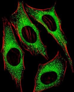 Invitrogen FGFR2 Polyclonal Antibody 400 &mu;L; Unconjugated:Antibodies,