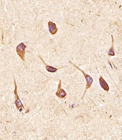 Invitrogen FGFR2 Polyclonal Antibody 400 &mu;L; Unconjugated:Antibodies,