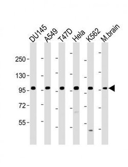 Invitrogen FGFR2 Polyclonal Antibody 400 &mu;L; Unconjugated:Antibodies,