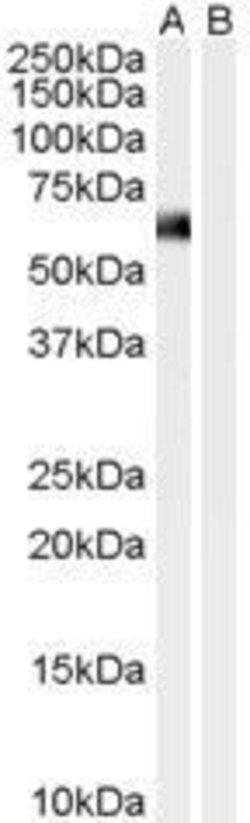 Invitrogen Syntrophin alpha-1 Polyclonal Antibody 100 &mu;g; Unconjugated:Antibodies,