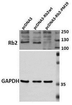 Invitrogen p130 Polyclonal Antibody 50 &mu;L; Unconjugated:Antibodies,