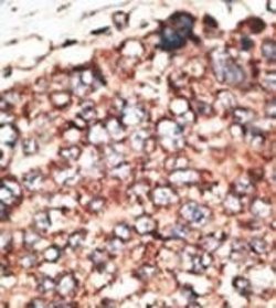 Invitrogen MMP17 Polyclonal Antibody 400 &mu;L; Unconjugated:Antibodies,