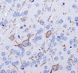 Invitrogen TACR1 Polyclonal Antibody 100 &mu;L | Buy Online | Invitrogen&trade; | Fisher Scientific