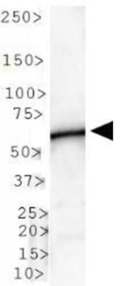 Invitrogen PLTP Polyclonal Antibody 200 &mu;L; Unconjugated:Antibodies,