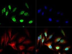 Invitrogen NuMA Polyclonal Antibody 100 &mu;L; Unconjugated:Antibodies,