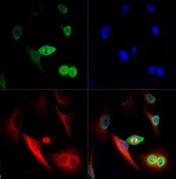 Invitrogen NuMA Polyclonal Antibody 100 &mu;L; Unconjugated:Antibodies,