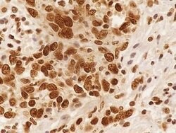 Invitrogen NuMA Polyclonal Antibody 100 &mu;L; Unconjugated:Antibodies,