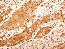 Invitrogen NuMA Polyclonal Antibody 100 &mu;L; Unconjugated:Antibodies,