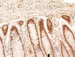 Invitrogen NuMA Polyclonal Antibody 100 &mu;L; Unconjugated:Antibodies,