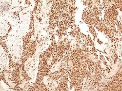 Invitrogen NuMA Polyclonal Antibody 100 &mu;L; Unconjugated:Antibodies,