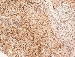Invitrogen NuMA Polyclonal Antibody 100 &mu;L; Unconjugated:Antibodies,