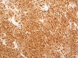 Invitrogen NuMA Polyclonal Antibody 100 &mu;L; Unconjugated:Antibodies,