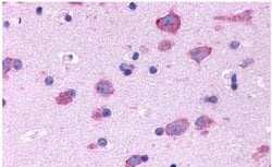 HTR2B Polyclonal Antibody, Invitrogen™